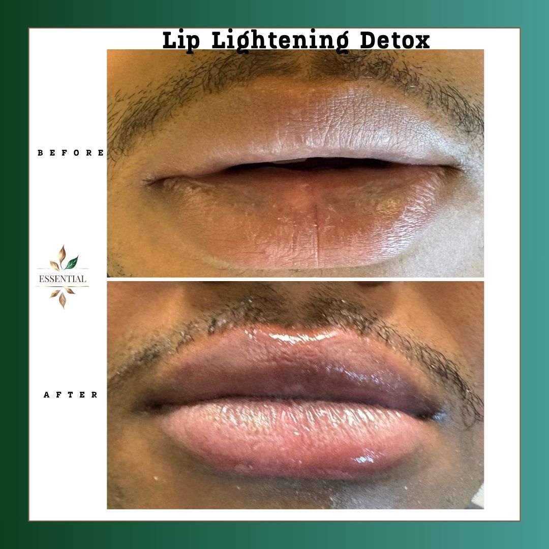 Comparison of lips before and after detox treatment, showing improved lip color and texture, with visible gloss and hydration.