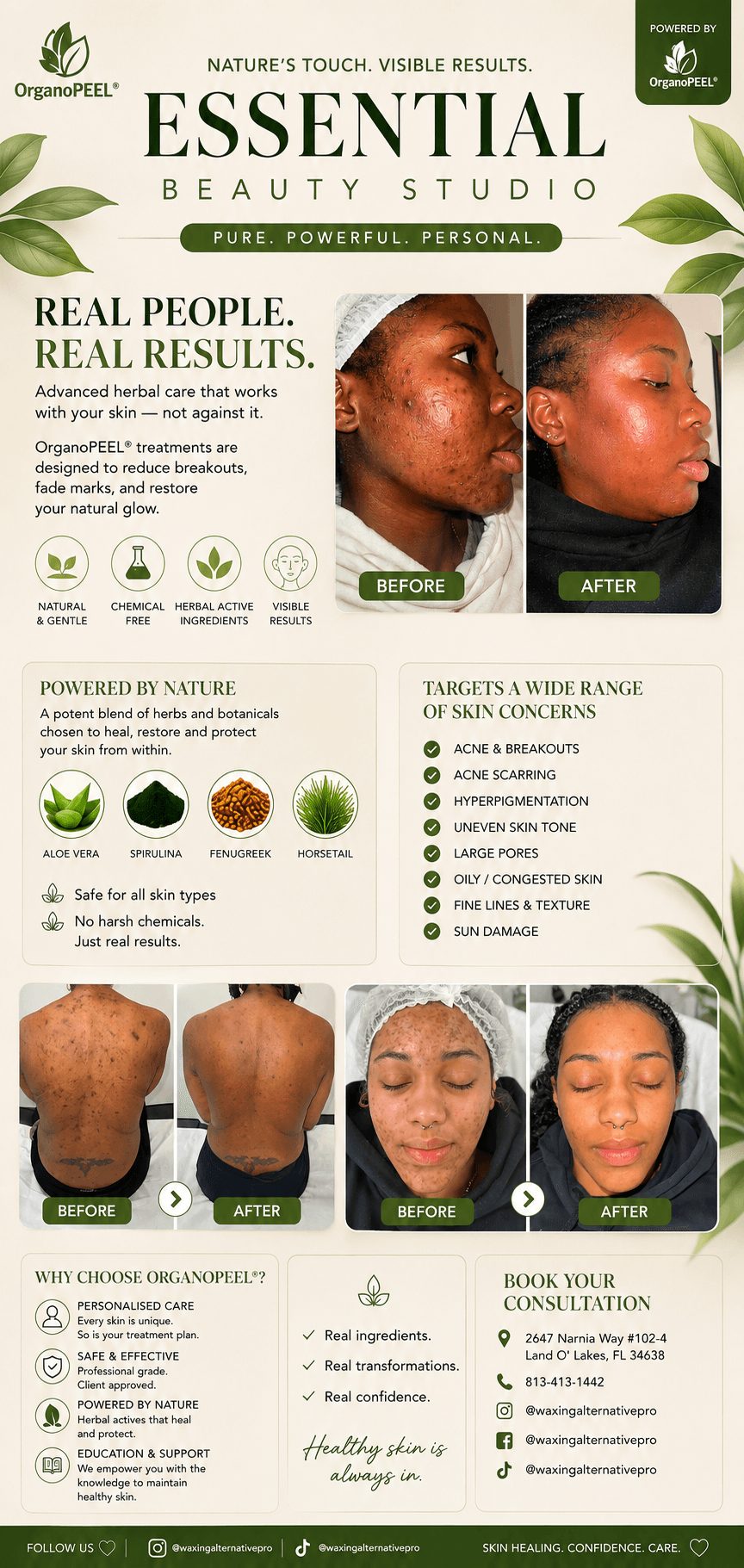 Before and after images of a woman's face showing skin improvement, with text about skincare results and product benefits.